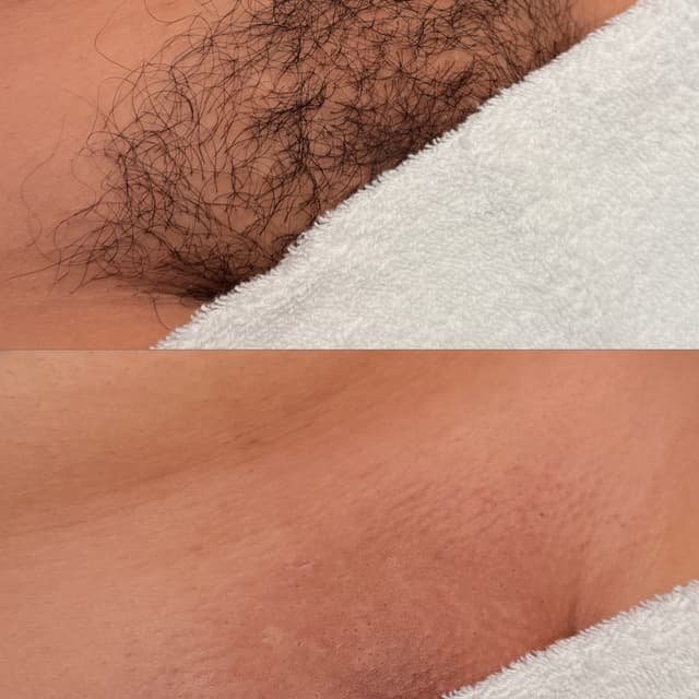 Brazilian wax 4 pk (Lock in rate) at Chula Beautyy in Los Alamitos, CA